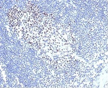 Recombinant MSH2 Antibody