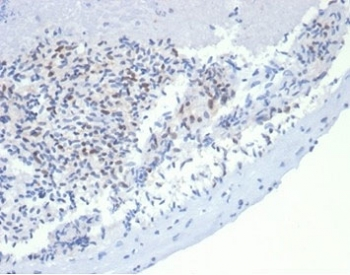 Recombinant MSH2 Antibody