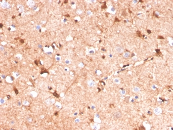 S100B Antibody