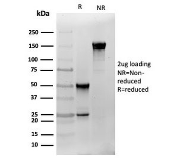 S100B Antibody
