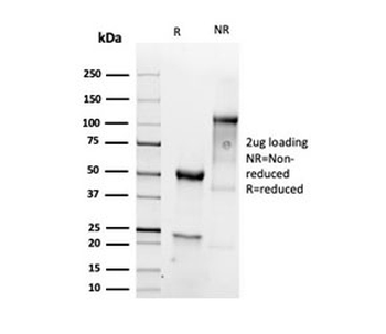 Recombinant Vimentin Antibody