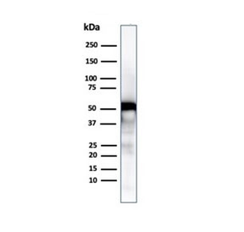 Recombinant Vimentin Antibody