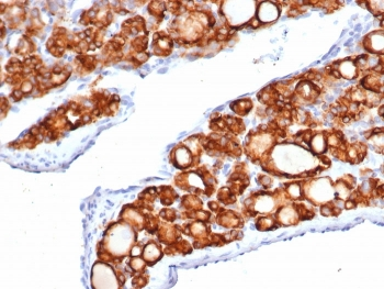Thyroid Peroxidase Antibody