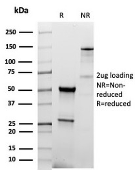 Thyroid Peroxidase Antibody