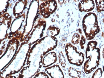Recombinant HSP60 Antibody