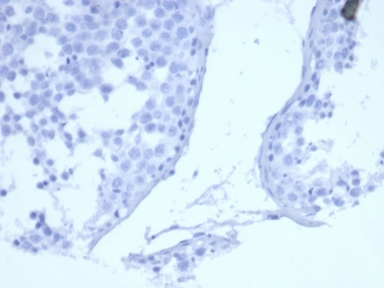 EGF Receptor / EGFR Antibody (Extracellular domain)