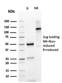 Recombinant PARVG Antibody / Gamma Parvin