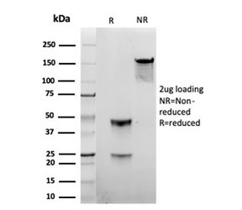 Gamma Parvin Antibody / PARVG