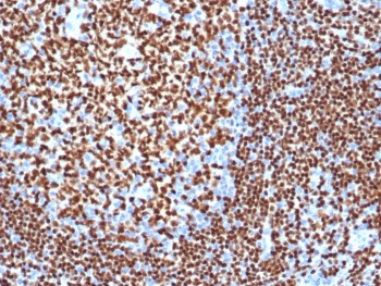 Recombinant PAX5 Antibody