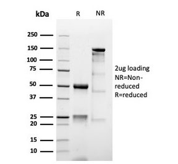 MUC1 Antibody / Mucin-1