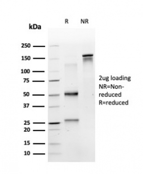 MSK1 Antibody / RPS6KA5
