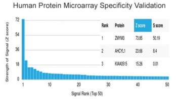 ZMYM3 Antibody