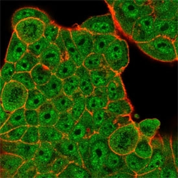 ZBED1 Antibody / DREF