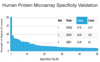 ZNF622 Antibody / ZPR9