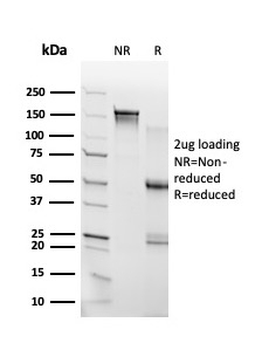THG1 Antibody / RHOXF2