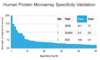 ZNF408 Antibody / PRDM17