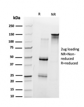 Ubiquitin-protein ligase E3A Antibody / UBE3A