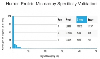 Ubiquitin-conjugating enzyme E2 B Antibody / UBE2B [Out of stock]