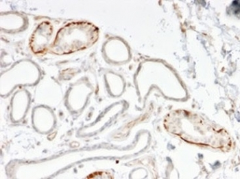 GTF2H2C Antibody
