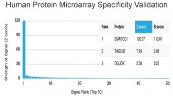 SMARCC1 Antibody / BAF155