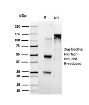SMARCC1 Antibody / BAF155