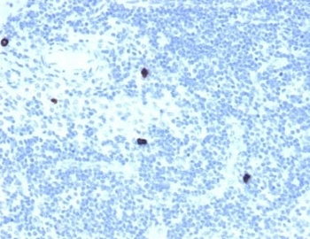 RXR beta Antibody / RXRB