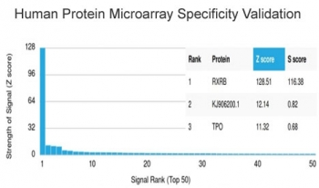 RXR beta Antibody / RXRB