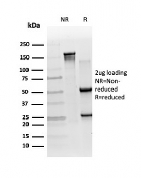 RXR beta Antibody / RXRB