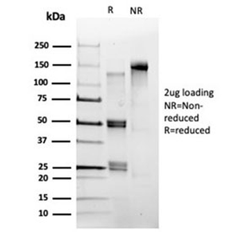 POLE3 Antibody / CHRAC-17
