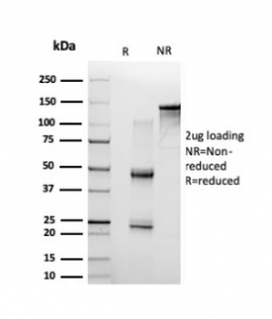 p65 Antibody / NF-kB