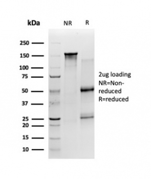 SIRT2 Antibody
