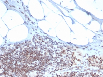 ZBTB46 Antibody / BTBD4 / ZNF340