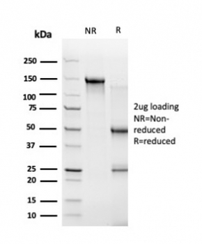 ZBTB46 Antibody / BTBD4 / ZNF340
