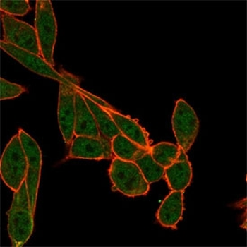 SMNDC1 Antibody