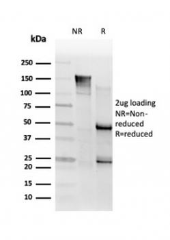 SMNDC1 Antibody
