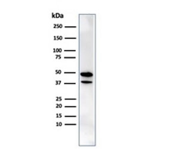 CREB5 Antibody / CRE-BPa