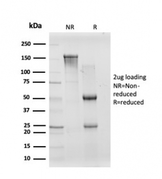 CREB5 Antibody / CRE-BPa