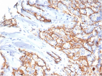 CD133 Antibody / PROM1 (Extracellular Region)