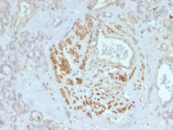 HOMEZ Antibody