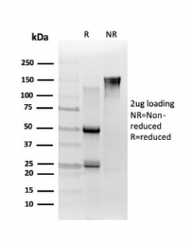 TCF25 Antibody / Transcription factor 25