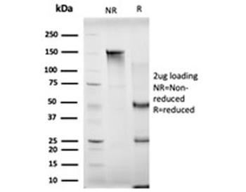 MBNL3 Antibody