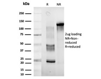 DDX41 Antibody