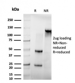 IRF3 Antibody