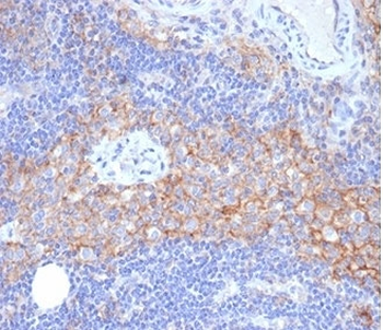 ICAM1 Antibody / CD54