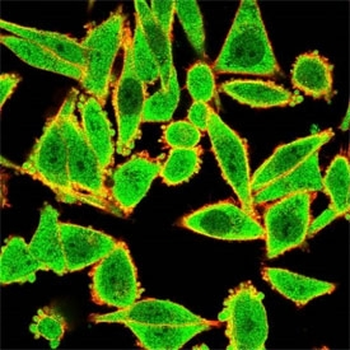GTF2H2 Antibody / BTF2 p44 / TFIIH