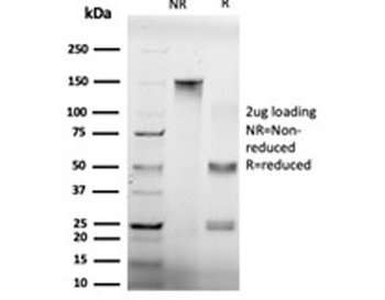 GTF2H2 Antibody / BTF2 p44 / TFIIH