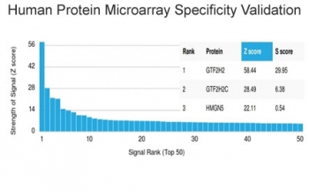 GTF2H2 Antibody / BTF2 p44 / TFIIH