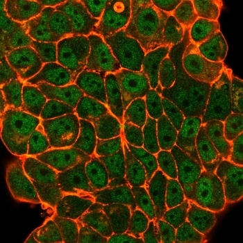 ELK1 Antibody