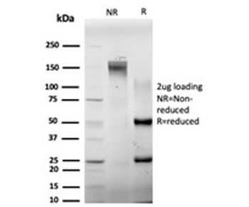 ELK1 Antibody