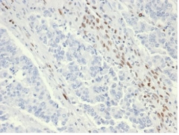 Recombinant MSH6 Antibody